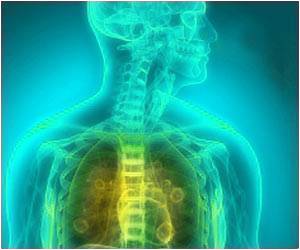 Rare Lung Complication Among Kids With Severe Form of Arthritis Rare Lung Complication Among Kids With Severe Form of Arthritis
