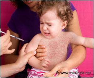 Measles Infection Makes Us Vulnerable to Other Diseases Measles Infection Makes Us Vulnerable to Other Diseases