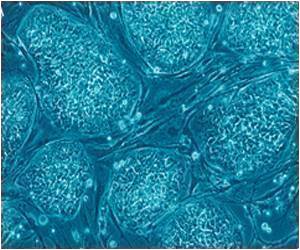Key Role in Hair Regeneration Identified Key Role in Hair Regeneration Identified
