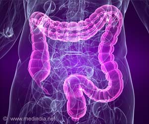 Certain Gut Bacteria May be the Reason for Bowel Cancer Certain Gut Bacteria May be the Reason for Bowel Cancer