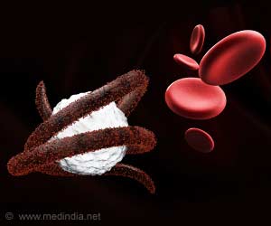 Ebola: New Transmission Model Helps Predict Uganda Cases Ebola: New Transmission Model Helps Predict Uganda Cases