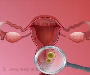 Cervical Cancer Screening Numbers Drop Off in Women 45-65: Study Cervical Cancer Screening Numbers Drop Off in Women 45-65: Study