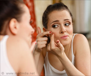 Does Blue Light Therapy Help Acne? Does Blue Light Therapy Help Acne?