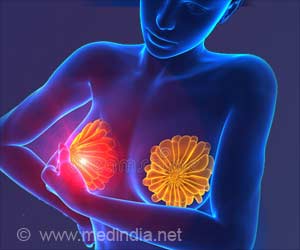New Insights Identify Cause and Treatments for Aggressive Form of Breast Cancer New Insights Identify Cause and Treatments for Aggressive Form of Breast Cancer