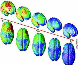 Brains of Girls and Boys are Similar Brains of Girls and Boys are Similar