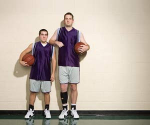 Taller People at Increased Risk for Atrial Fibrillation Taller People at Increased Risk for Atrial Fibrillation