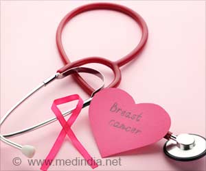 Survival Time for Women With Breast Cancer: Fresh Insights Survival Time for Women With Breast Cancer: Fresh Insights