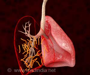 New Guideline for Treating and Preventing Drug-resistant TB New Guideline for Treating and Preventing Drug-resistant TB