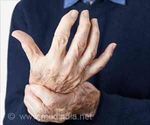 Thermal Cameras can Help Detect Rheumatoid Arthritis Thermal Cameras can Help Detect Rheumatoid Arthritis