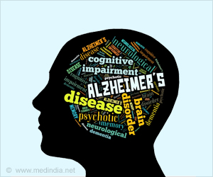 Low-dose Radiation Therapy Helps Treat Alzheimers Disease Low-dose Radiation Therapy Helps Treat Alzheimers Disease