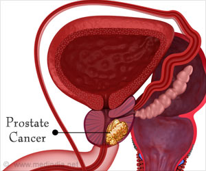 Olaparib: The First Gene-targeted Drug Effective in Prostate Cancer