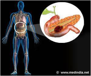Pancreatic Cancer Treatment Has Low Progress Pancreatic Cancer Treatment Has Low Progress