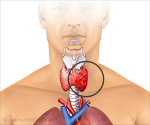Study Offers New Insights into Thyroid Cancer Rates in US Study Offers New Insights into Thyroid Cancer Rates in US
