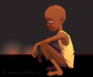 Form of Severe Malnutrition Tied to DNA Modification Form of Severe Malnutrition Tied to DNA Modification
