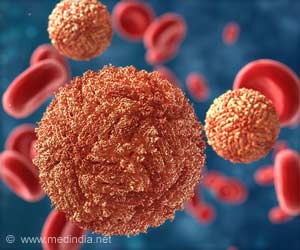 Vaccine Against Zika Safeguards Baby in Pregnant Monkeys Vaccine Against Zika Safeguards Baby in Pregnant Monkeys