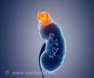 Mysterious Circular DNA Causes Cancer in Kids Mysterious Circular DNA Causes Cancer in Kids