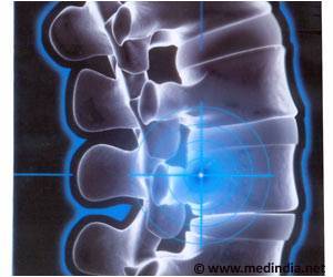 Spine Surgery is Safe in Elderly Patients: Study Spine Surgery is Safe in Elderly Patients: Study
