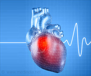 Personalized Medicine for the Common Cardiac Arrhythmia Personalized Medicine for the Common Cardiac Arrhythmia