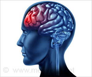 Homeless People Show High Prevalence of Traumatic Brain Injury Homeless People Show High Prevalence of Traumatic Brain Injury