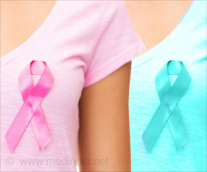 Causes of Death in US Breast Cancer Survivors: Study Causes of Death in US Breast Cancer Survivors: Study