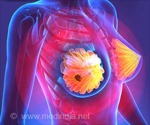 Breast Cancer Patients Need To be Genetically Evaluated Breast Cancer Patients Need To be Genetically Evaluated