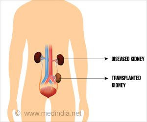 Many Kids With Renal Issue may be Prescribed Toxic Drugs Many Kids With Renal Issue may be Prescribed Toxic Drugs