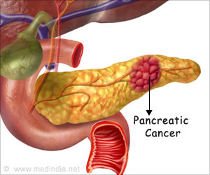 Tropical Flower Offers Hope in Pancreatic Cancer Treatment Tropical Flower Offers Hope in Pancreatic Cancer Treatment