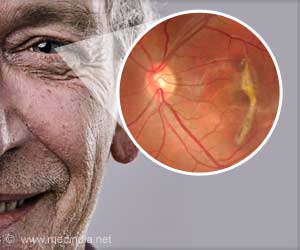 Poor Diet Raises Risk of Vision Loss in Later Life Poor Diet Raises Risk of Vision Loss in Later Life