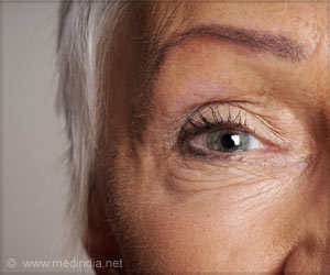 Poor Diet may be a Risk Factor for Age-related Macular Degeneration Poor Diet may be a Risk Factor for Age-related Macular Degeneration