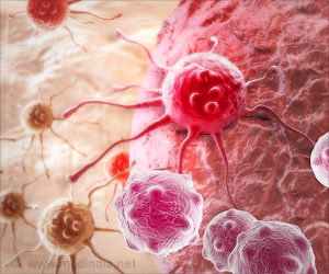 New Software Tool Uses AI to Aid Doctors to Identify Cancer Cells New Software Tool Uses AI to Aid Doctors to Identify Cancer Cells
