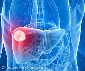 Body Can Fight Cancer By Giving Antibiotic Before Radiation Body Can Fight Cancer By Giving Antibiotic Before Radiation