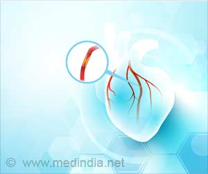 Link Between Cholesterol Levels and Heart Disease Risk Identified Link Between Cholesterol Levels and Heart Disease Risk Identified