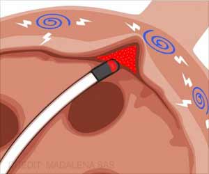 Irregular Heartbeat may Lead to More Effective Treatment: Deep Insights Irregular Heartbeat may Lead to More Effective Treatment: Deep Insights