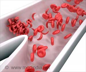 Identifying Type of Chronic Pain in Adults with Sickle Cell Disease may Help Improve Patient Outcomes Identifying Type of Chronic Pain in Adults with Sickle Cell Disease may Help Improve Patient Outcomes