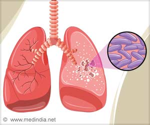 Drug-resistant Strains of TB Could be Controlled Drug-resistant Strains of TB Could be Controlled