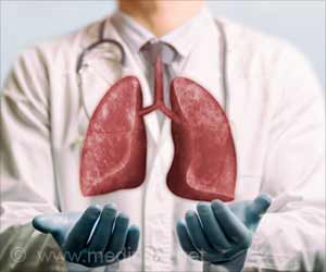 Using Lungs from Increased-risk Donors Expands Donor Pool, Maintains Current Survival Rates: Study Using Lungs from Increased-risk Donors Expands Donor Pool, Maintains Current Survival Rates: Study