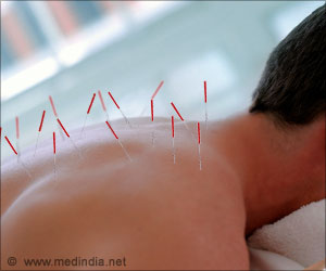Acupuncture can Decrease Radiation-induced Dry Mouth for Cancer Patients Acupuncture can Decrease Radiation-induced Dry Mouth for Cancer Patients