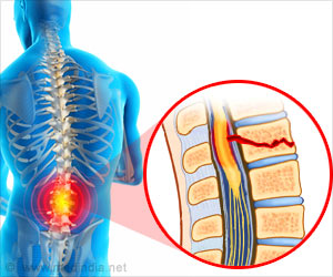 Limb Function Restored After Spinal Cord Injury Using This Drug Limb Function Restored After Spinal Cord Injury Using This Drug