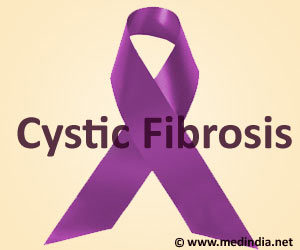 New Approach to Treat Cystic Fibrosis Lowers Risk of Lung Transplants New Approach to Treat Cystic Fibrosis Lowers Risk of Lung Transplants