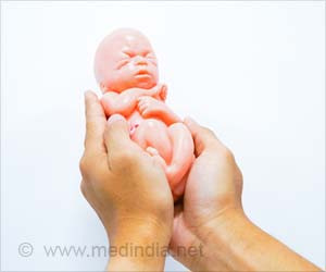 Is Is Miscarriage Caused By Disability? Is Is Miscarriage Caused By Disability?